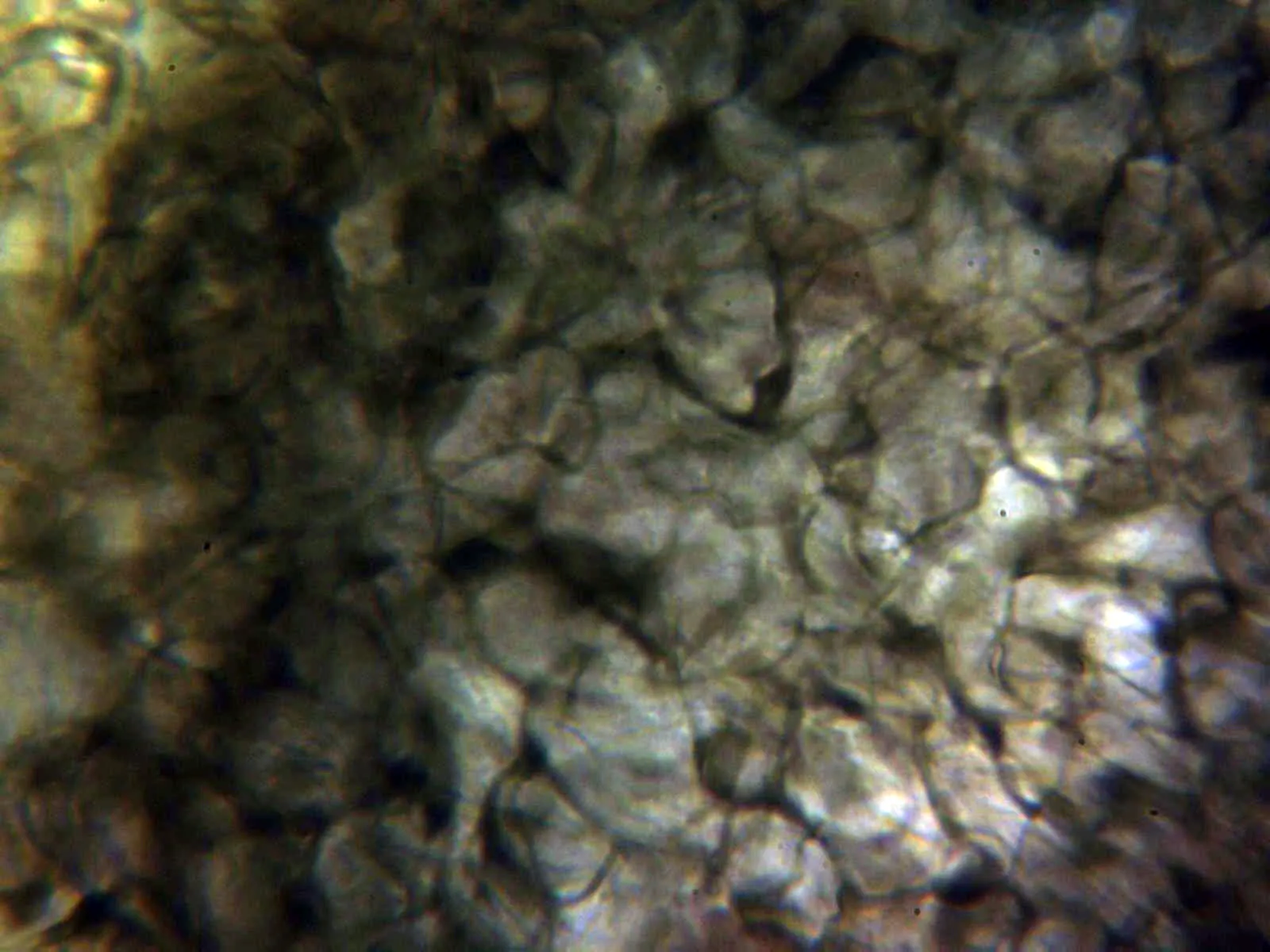 Microscopía de Botryosphaeria visci - 17 - Peridio